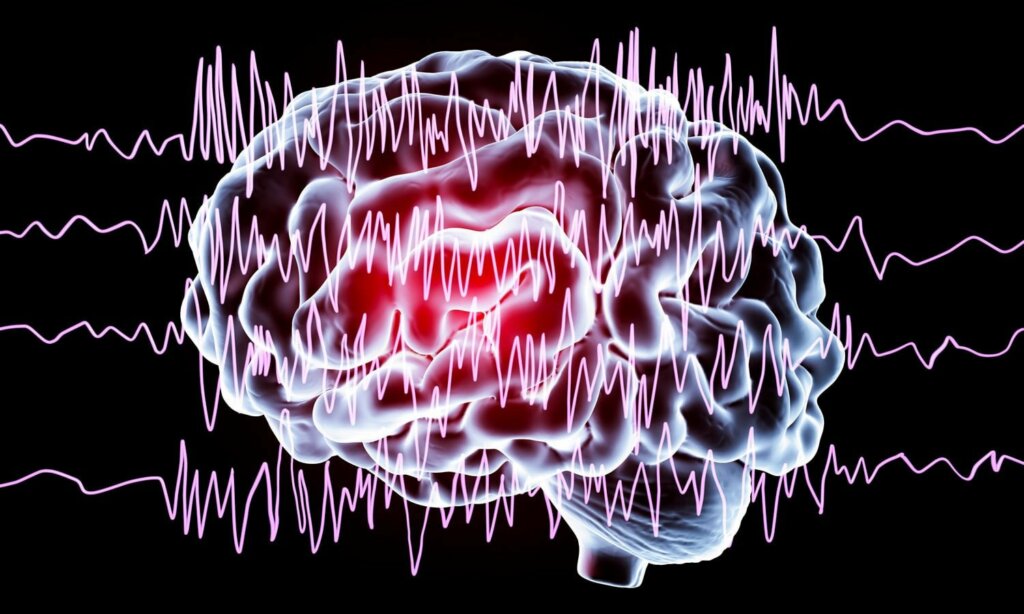 Discinesie Discinesia: ¿qué es? ¿cuáles son los síntomas?