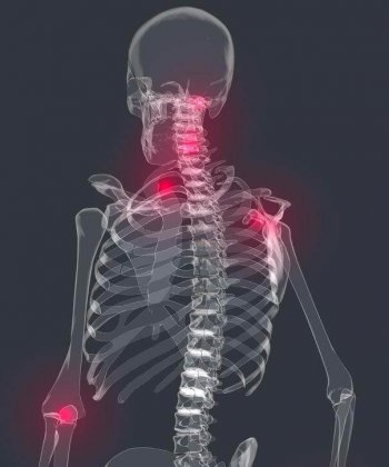 Aspectos psicológicos de la fibromialgia