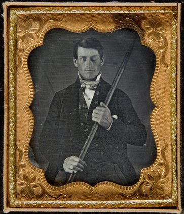 El asombroso caso de Phineas Gage