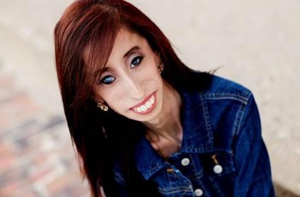 Lizzie Velásquez, ¿la mujer más fea del mundo?
