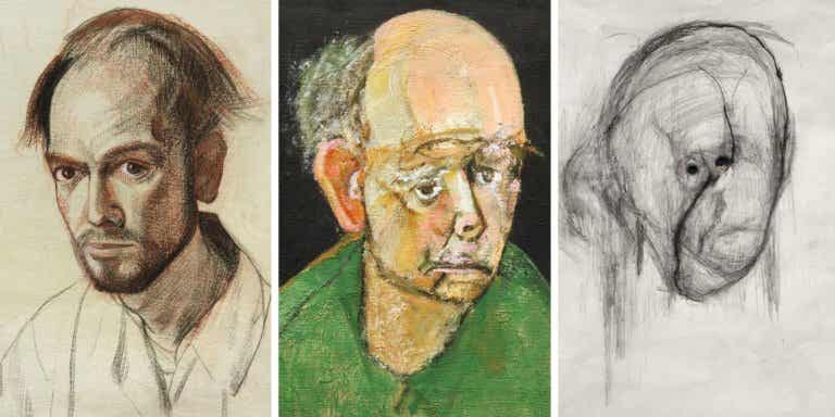 La evolución de la enfermedad el Alzheimer a través del arte