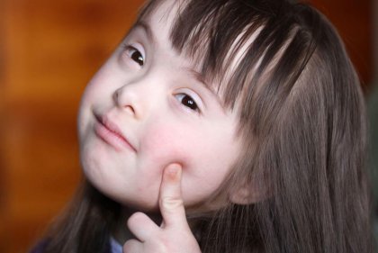 7 cosas del Síndrome de Down que necesitamos conocer