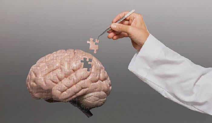 cerebro-puzzle