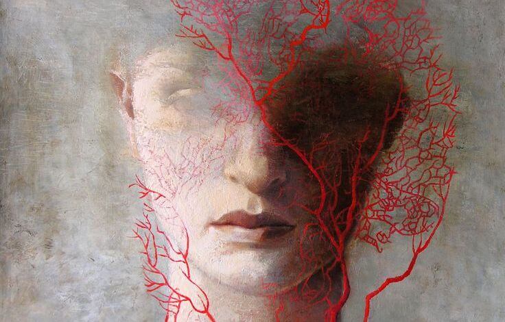 prosopagnosia