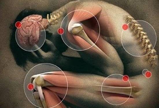 doença crônica da fibromialgia