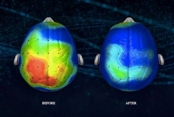 before and after meditation