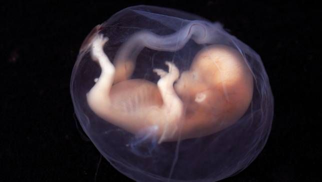 Imagen de un feto representando la relación entre la tiroides y embarazo