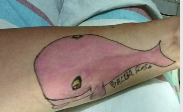 The pink whale tattoo.