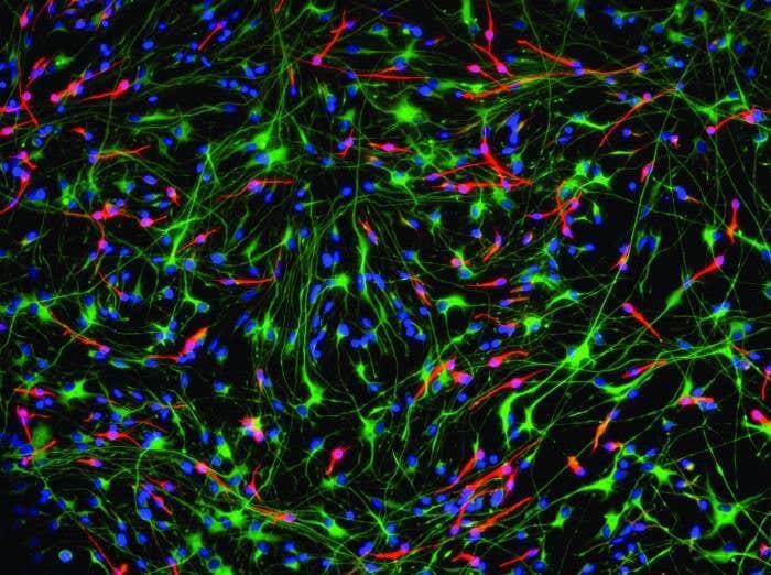 Neuronas en neurogénesis
