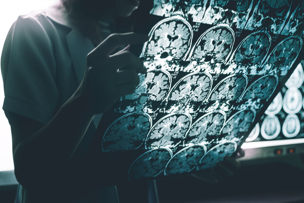 Radiografía cerebro