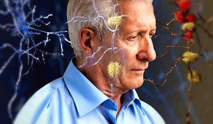 Homme plus âgé atteint d'Alzheimer