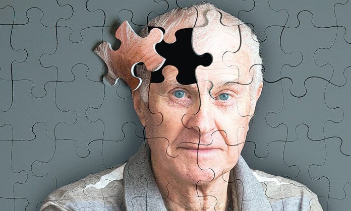 Resultado de imagen para Alzheimer