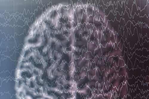 Cerebro con dibujo de ondas cerebrales