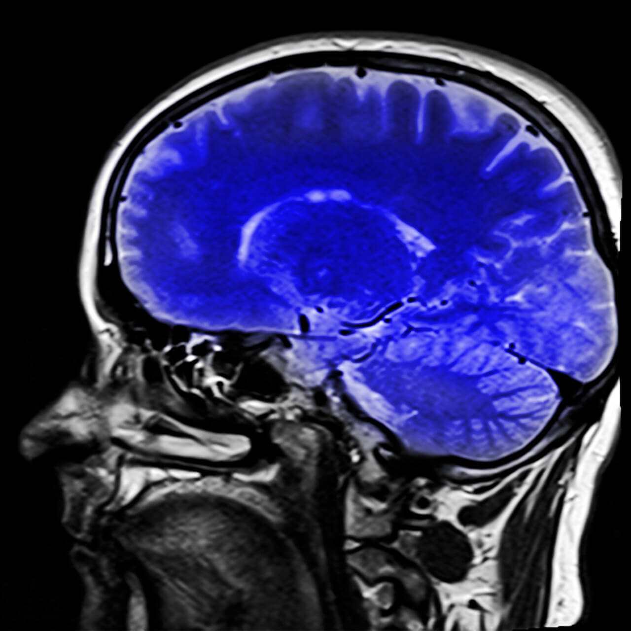 Imagen de cerebro