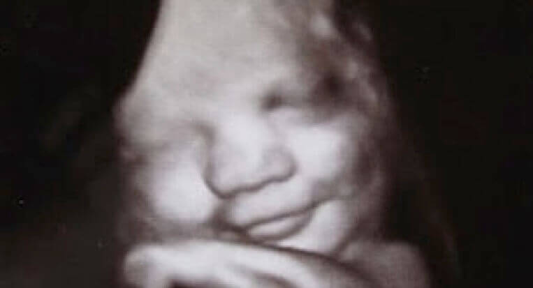 Bebé sonriendo en el útero