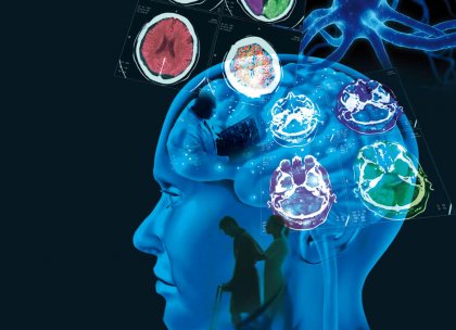 Esclerosis múltiple: causas, síntomas y tratamiento