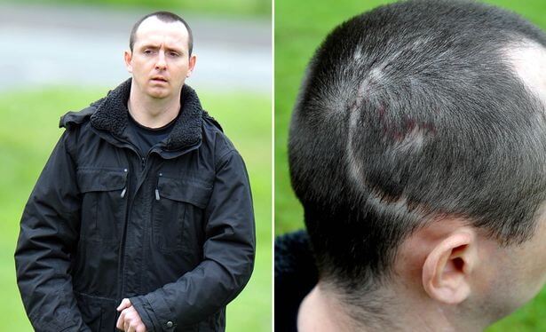 Paul Pugh, pathological laughter case.