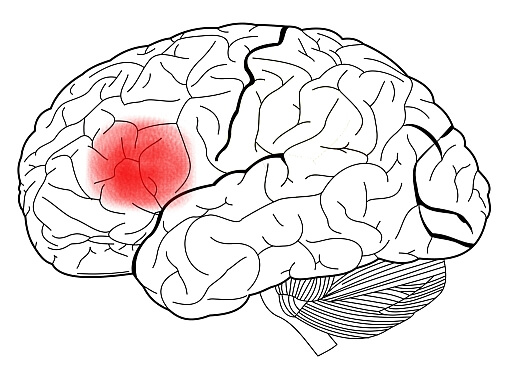 Cerebro con el área de Broca señalada en rojo