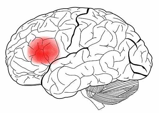 Cerebro con el área de Broca señalada en rojo