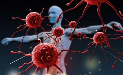 ¿Cómo puedes fortalecer tu sistema inmunológico?