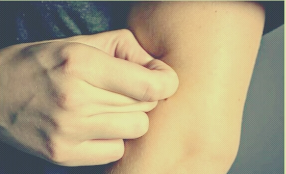 persona que sufre el trastorno por excoriación