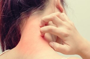 chica que se rasca la nuca debido a la dermatitis atópica