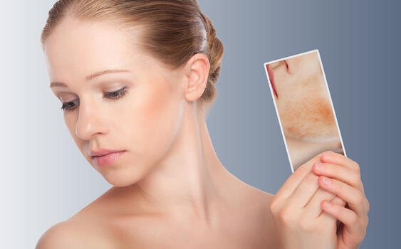 chica que se mira la dermatitis atópica en el espejo