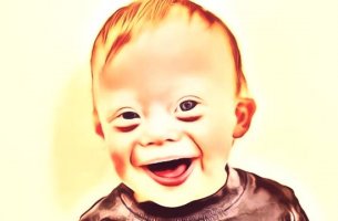Niño con síndrome de Down