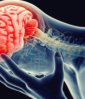 cerebro inflamado representando la teoría inflamatoria de la depresión