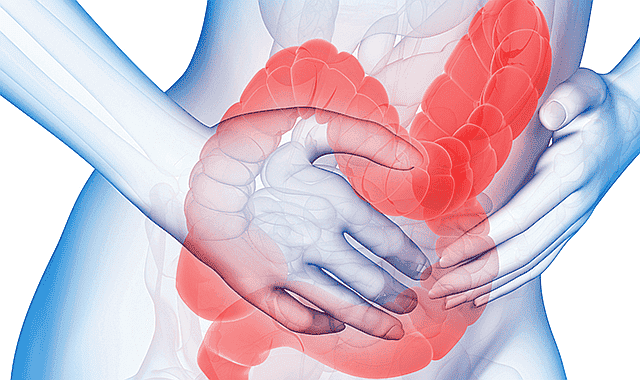 intestino simbolizando la relación entre el estrés y el síndrome de colon irritable