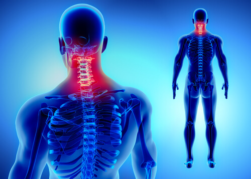 Hombre con latigazo cervical