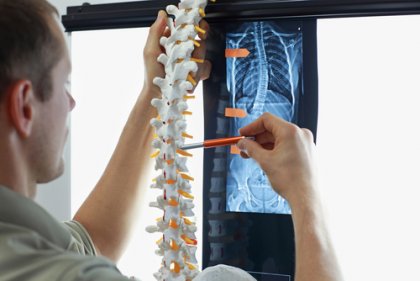 4 ejercicios para prevenir la escoliosis