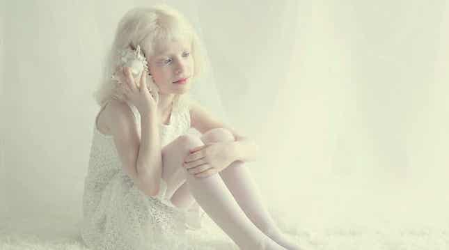 niña representando a las personas albinas