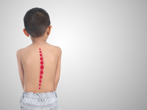 Niño con escoliosis