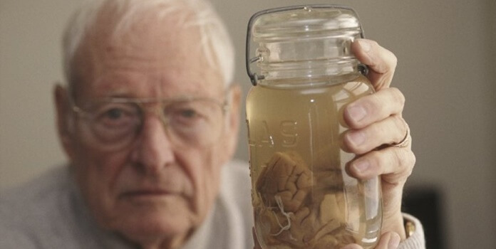 Harvey mostrando el cerebro de Albert Einstein