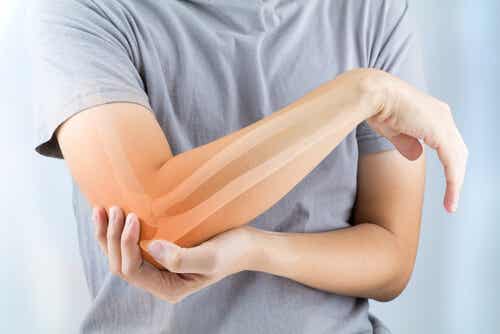 Artritis reumatoide: síntomas, causas y tratamiento