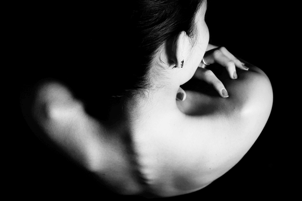 Espalda de una mujer con anorexia