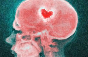 imagen de una radiografía simbolizando nuestro cerebro en una ruptura
