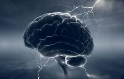 Cerebro con rayos representando la relación entre migrañas y dopamina