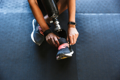 El síndrome del miembro fantasma