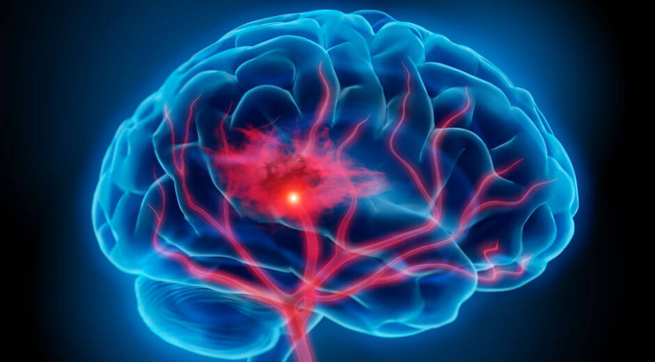 Cerebro iluminado