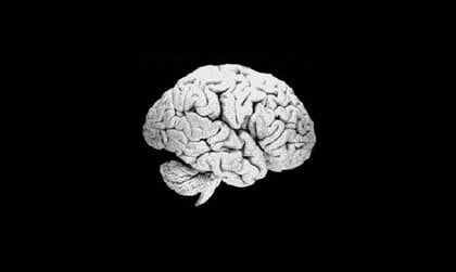 cerebro de un racista