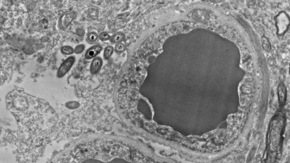 Microbioma cerebral: bacterias intestinales en el cerebro humano