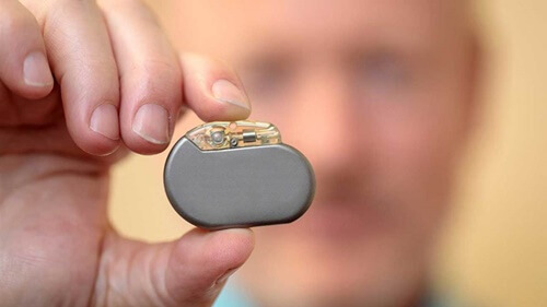 dispositivo la estimulación del nervio vago