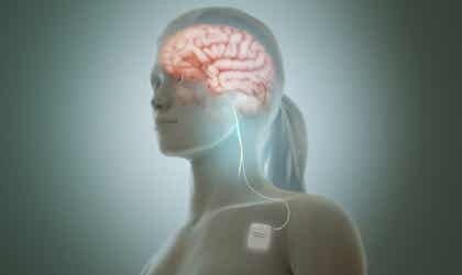 La estimulación del nervio vago reduce los síntomas de la depresión