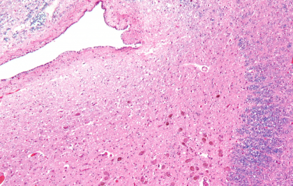 Locus coeruleus: anatomía y funciones