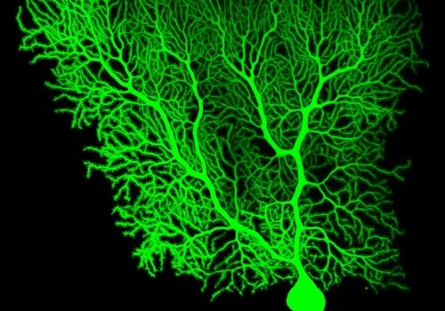 neuronas de Purkinje