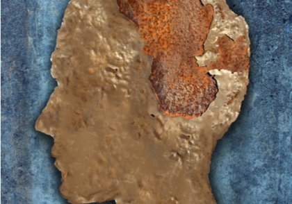 Encefalopatía espongiforme o enfermedad de las vacas locas