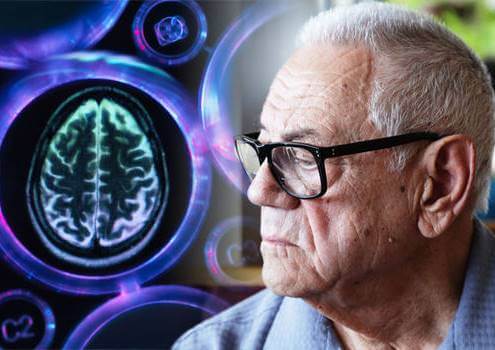 hombre con demencia vascular