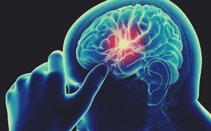 Déficit de vitamina B12 y deterioro cognitivo ¿qué relación hay?